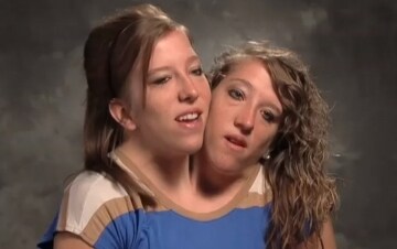 Unite per la vita: i 16 anni di Abby e Brittany: Guida TV - TV Sorrisi e Canzoni