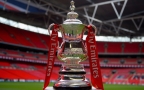 Episodio 20 - Chelsea - Hull City