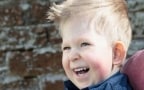 Il bambino nato senza cervello